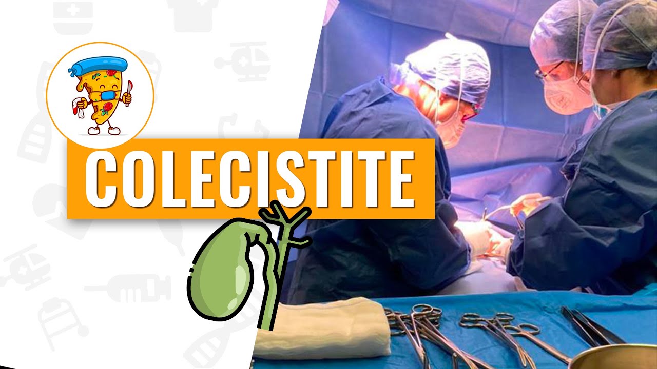 Colecistite acuta: tutto quello che devi sapere - Acute care surgery ft  @surgicalpizza652