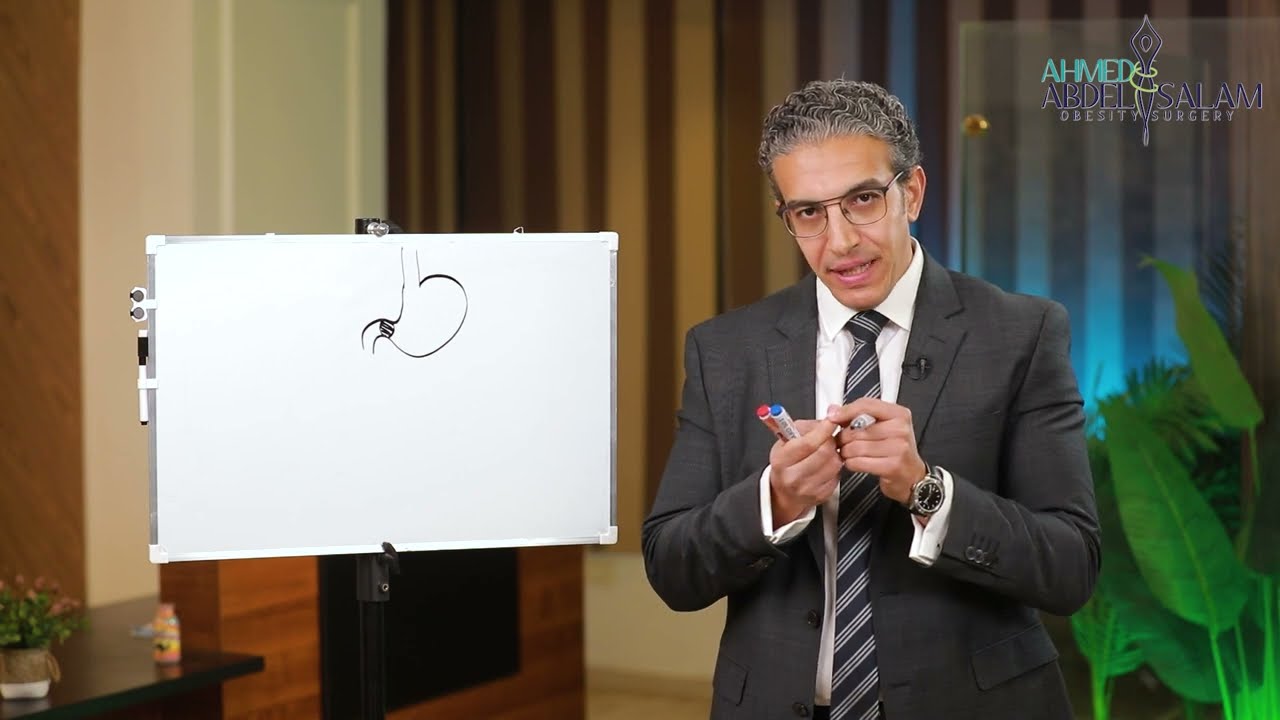 عملية SADI s نزول للوزن آمن بدون أي رجوع في الوزن عبر السنين