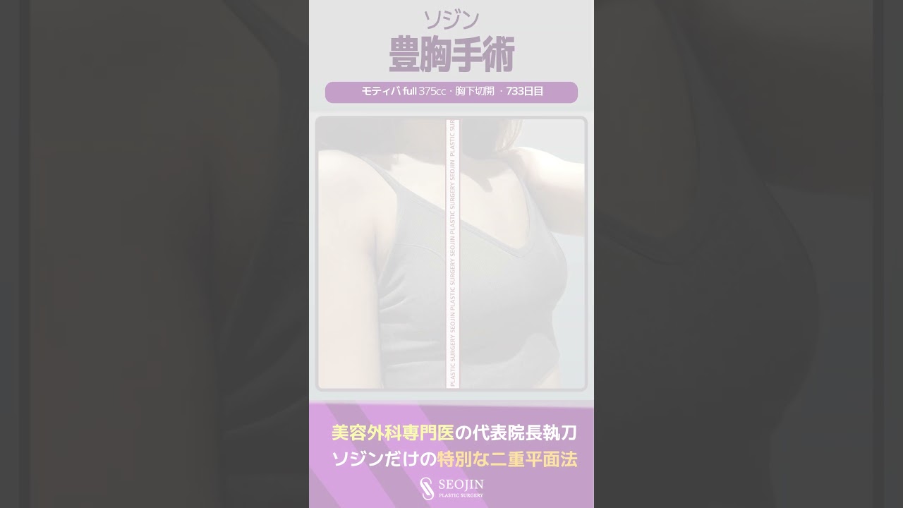 モティバ豊胸手術💜豊胸術、胸整形専門韓国ソジン整形美容外科💕