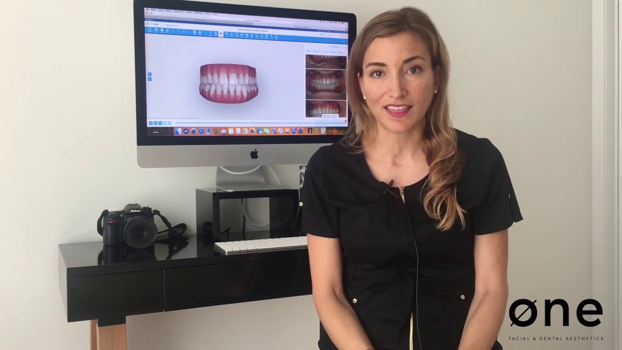 Implantes dentales provisionales | Dra. Ana Pedrol