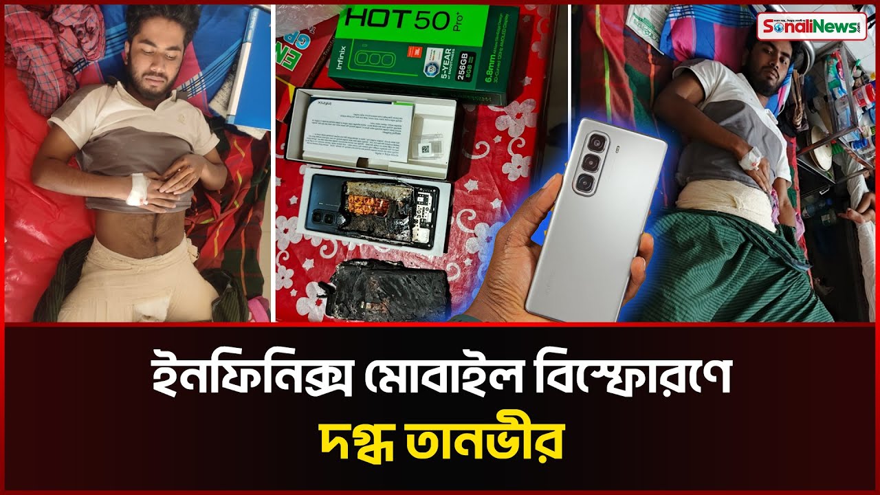 ঢামেকে যন্ত্রণায় কাতরাচ্ছেন ইনফিনিক্স স্মার্টফোন বিস্ফো-রণে দগ্ধ তানভীর | Infinix  | Sonali News