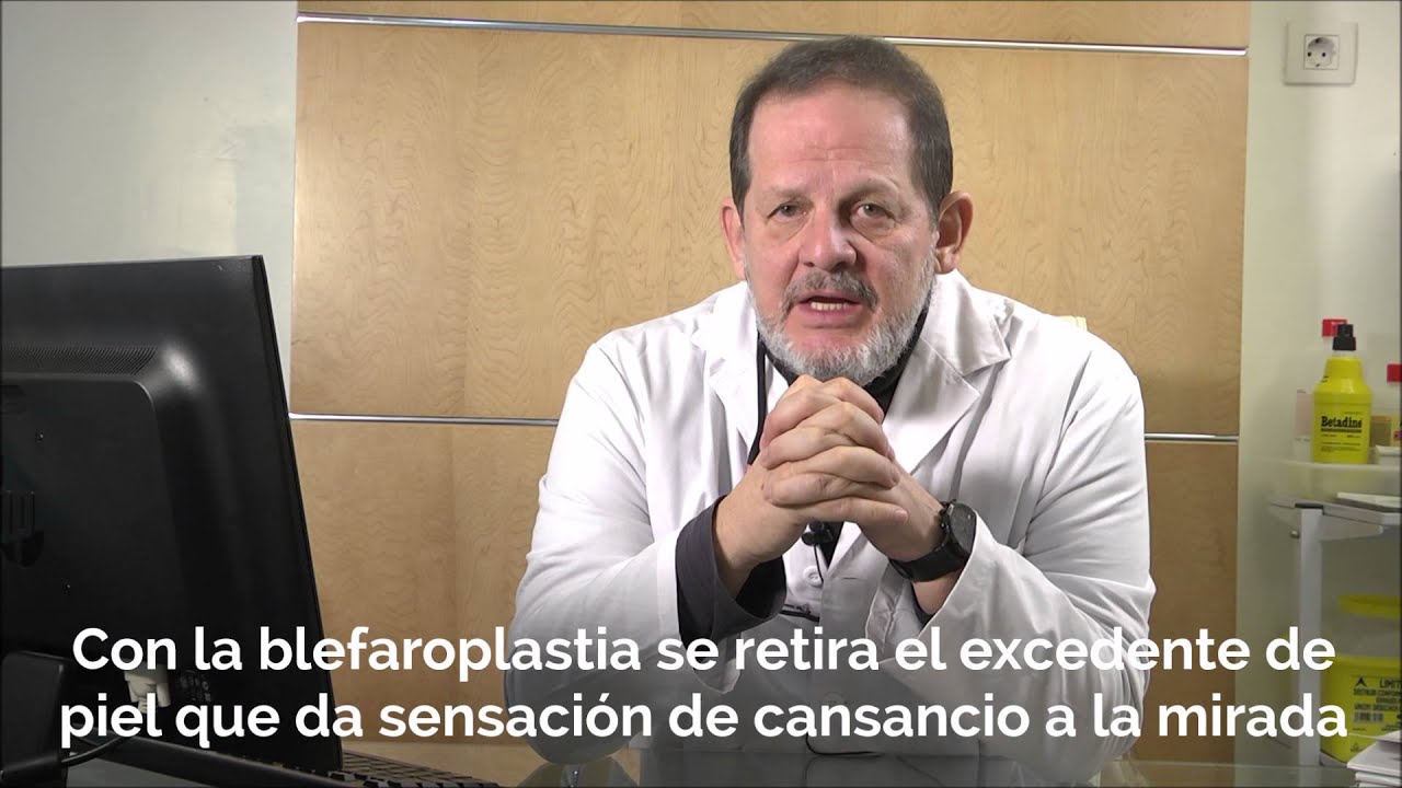 Blefaroplastia: todo sobre la operación de párpados