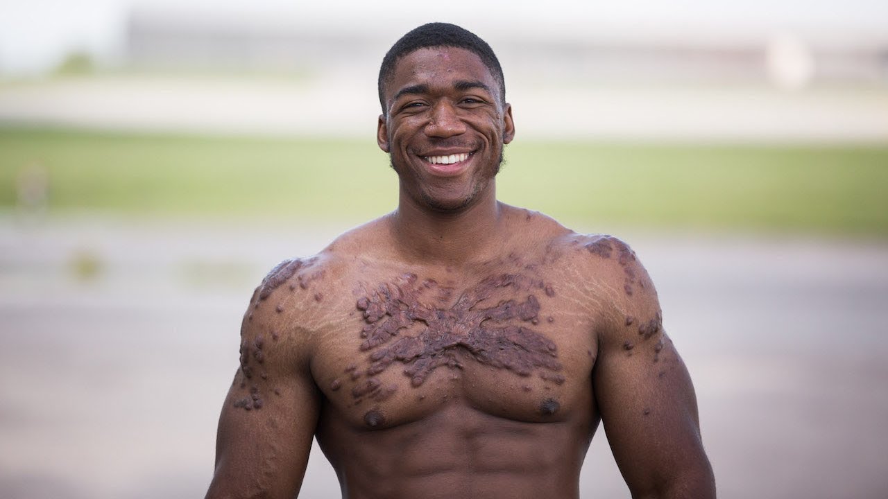 My Scars Won’t Kill My Bodybuilding Dreams | UNBREAKABLE ME
