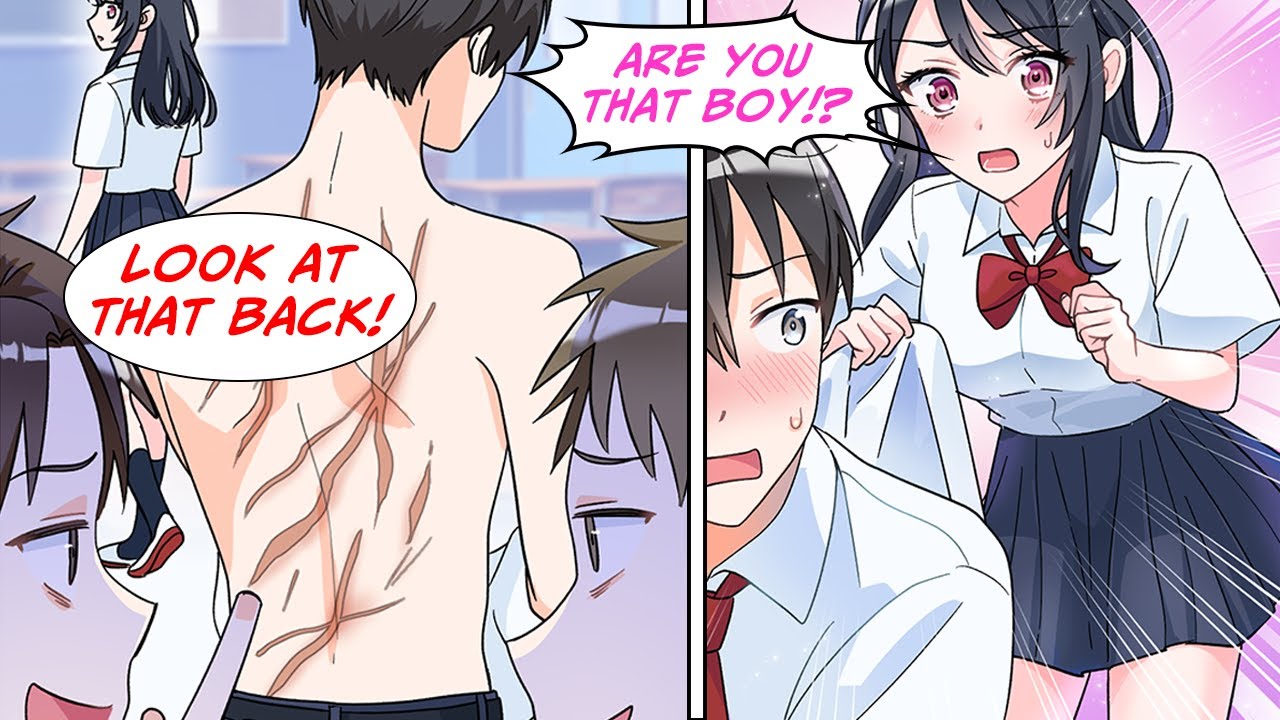 [Manga Dub] The new girl saw my scar that everyone makes fun of me for... [RomCom]