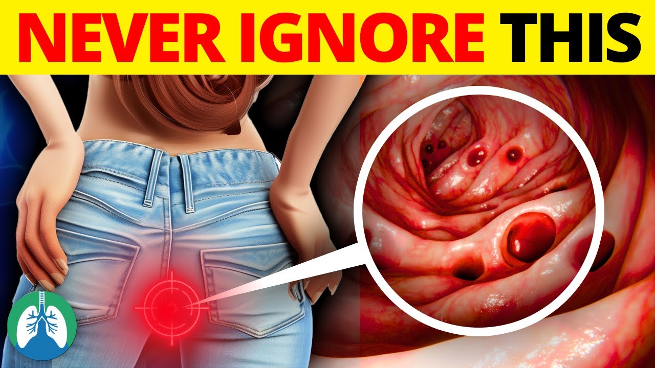 Top 10 Critical Colon Cancer Symptoms You Should Never Ignore