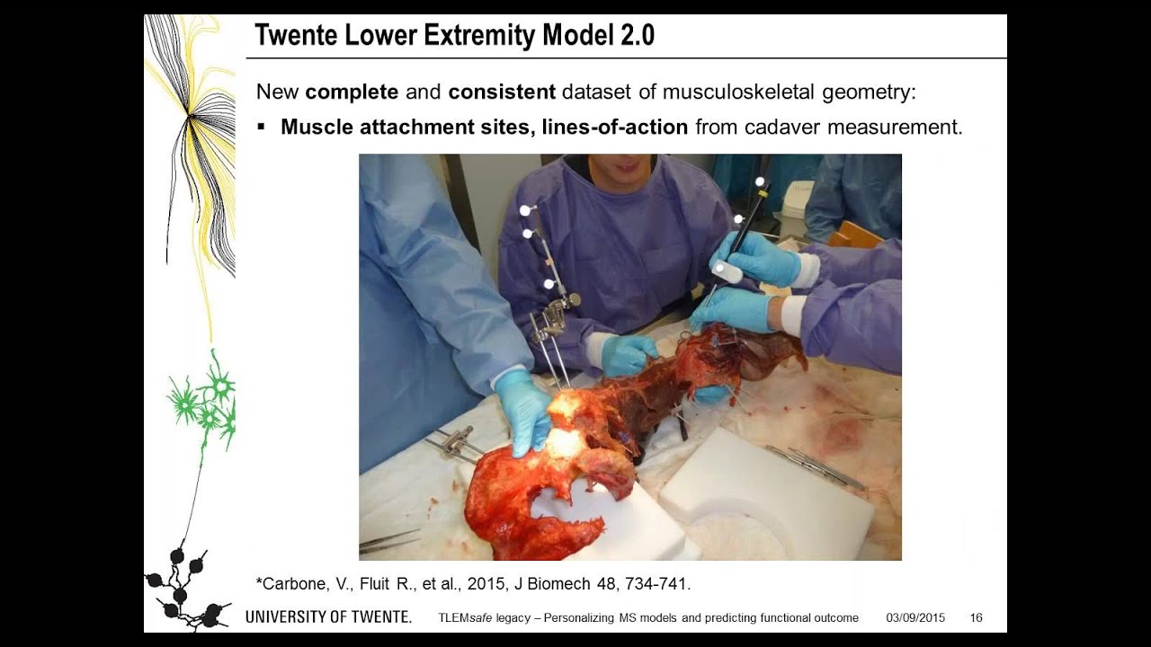 [Webcast] TLEMsafe - Personalization of musculoskeletal models and prediction of functional outcome