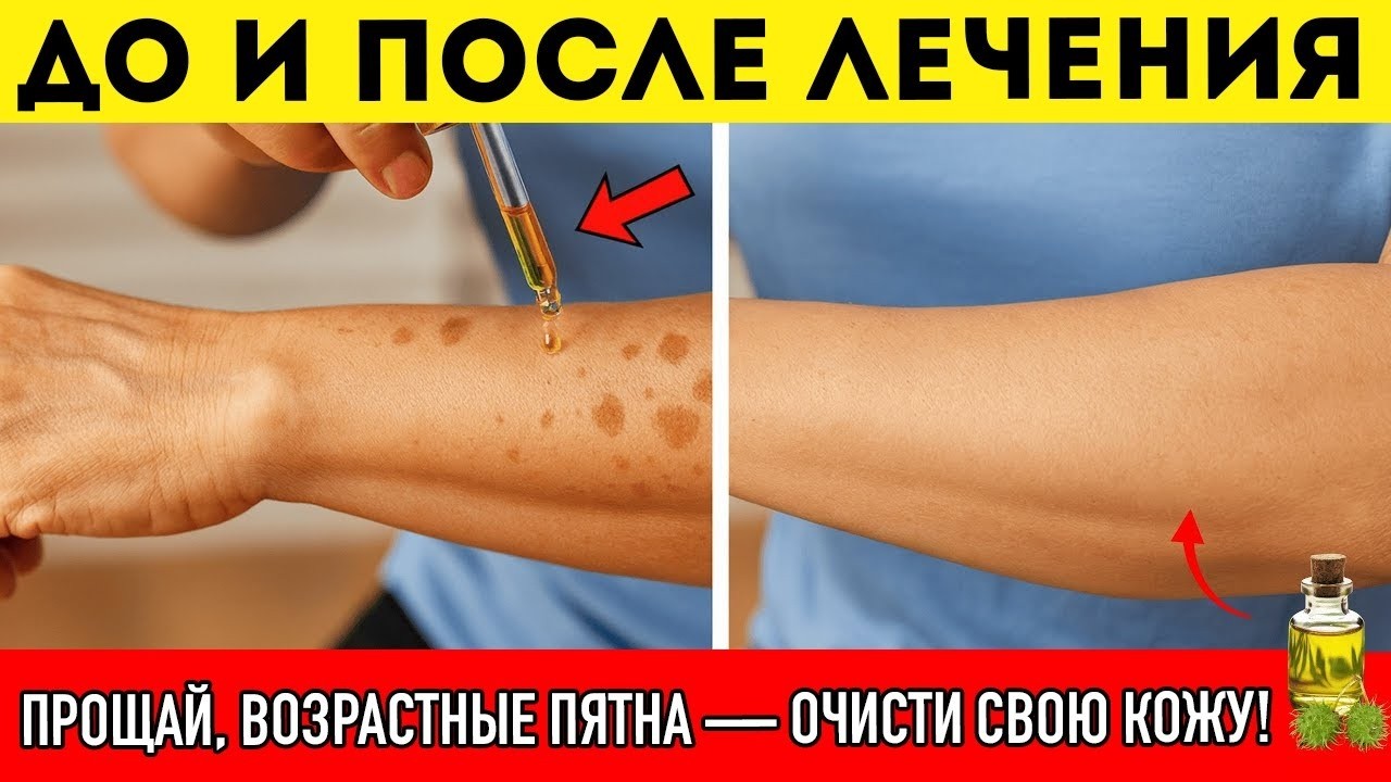 Дерматолог Раскрывает Натрите Этим Кожу — И Пятна Исчезнут Навсегда_2