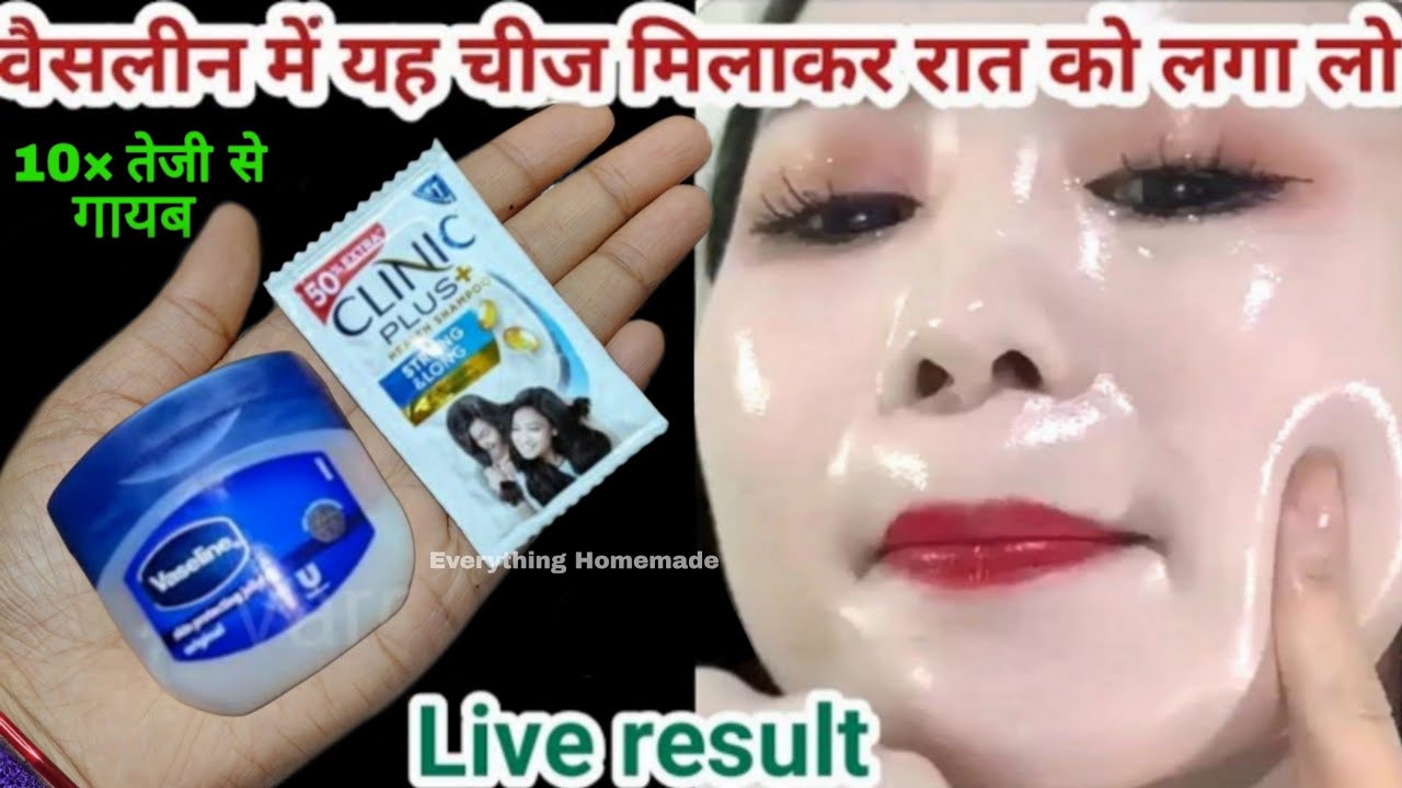 इस तरह से अपने चेहरे पर वैसलीन लगाएं और आपका चेहरा इतना गोरा हो जाएगा कि हर कोई देखेगा...
