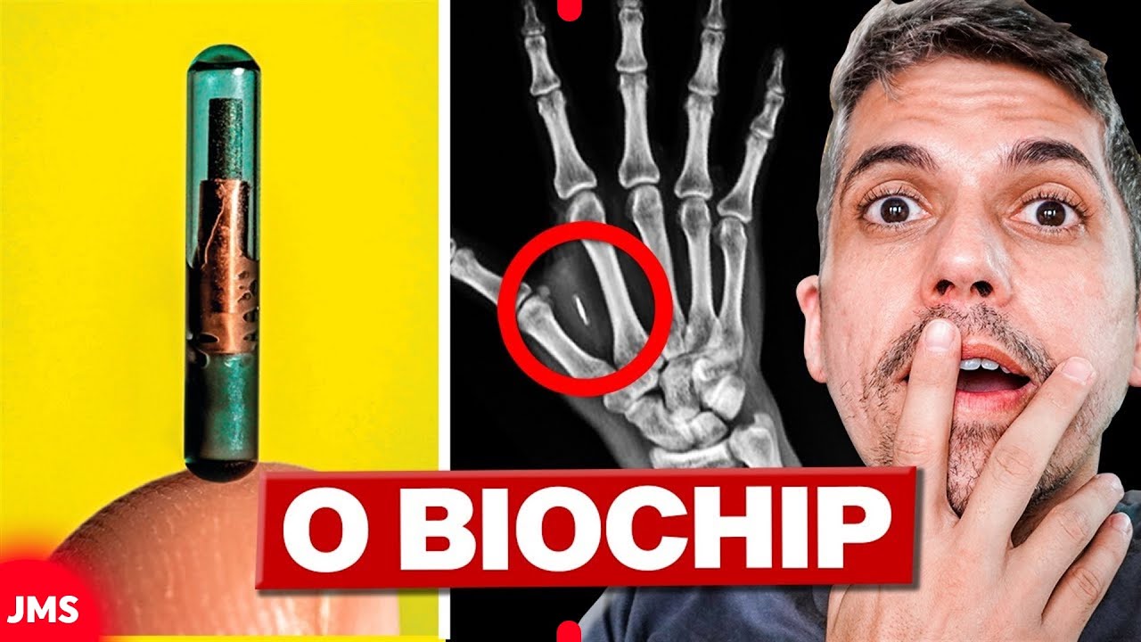 IMPLANTE DE CHIP NFC / RFID EM SERES HUMANOS - VOCÊ É CONTRA OU A FAVOR?