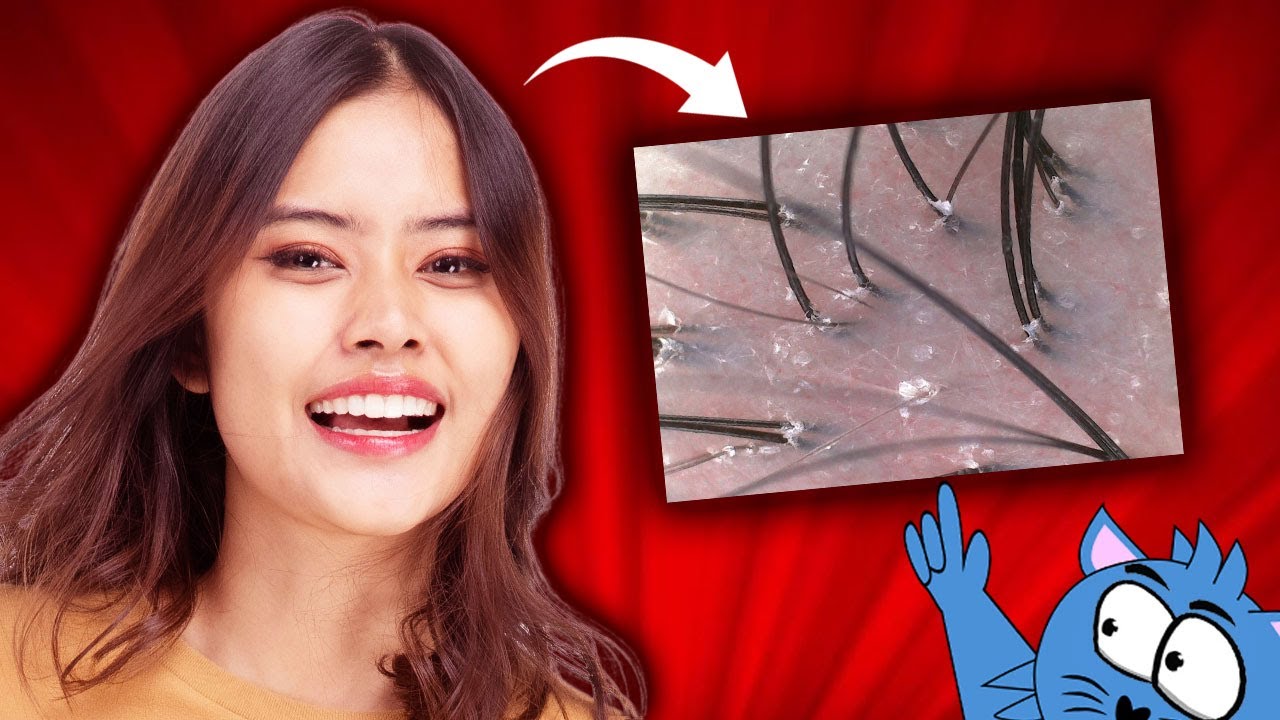 The Real Reason Why You&rsquo;ve Got Hair Problems Like Itchy Scalp