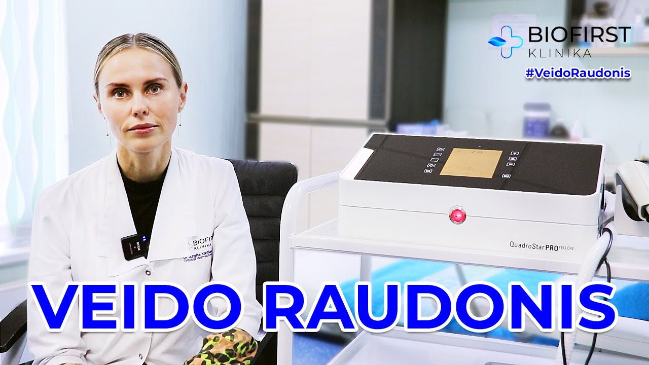 Veido raudonis: nuo ko atsiranda ir kaip jį gydyti? | dr. Jurgita Karčiauskienė