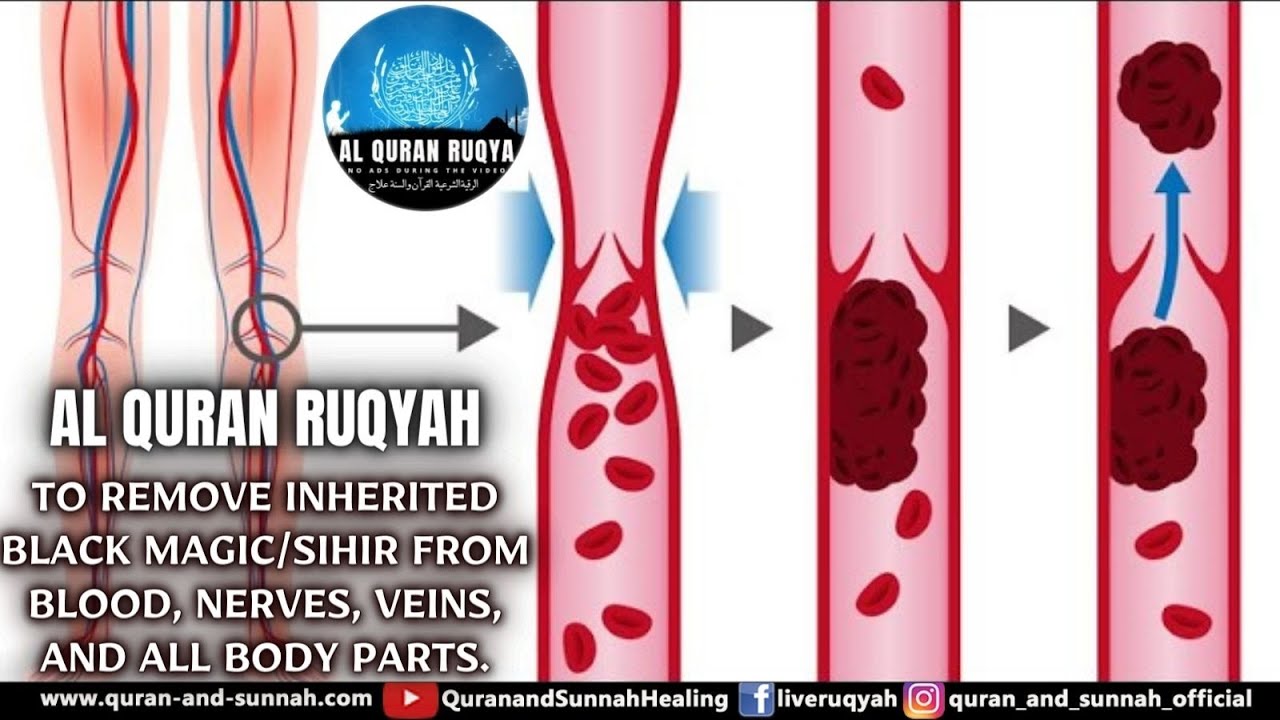 AL QURAN RUQYAH TO REMOVE INHERITED BLACK MAGIC/SIHIR FROM BLOOD, NERVES, VEINS, AND ALL BODY PARTS.