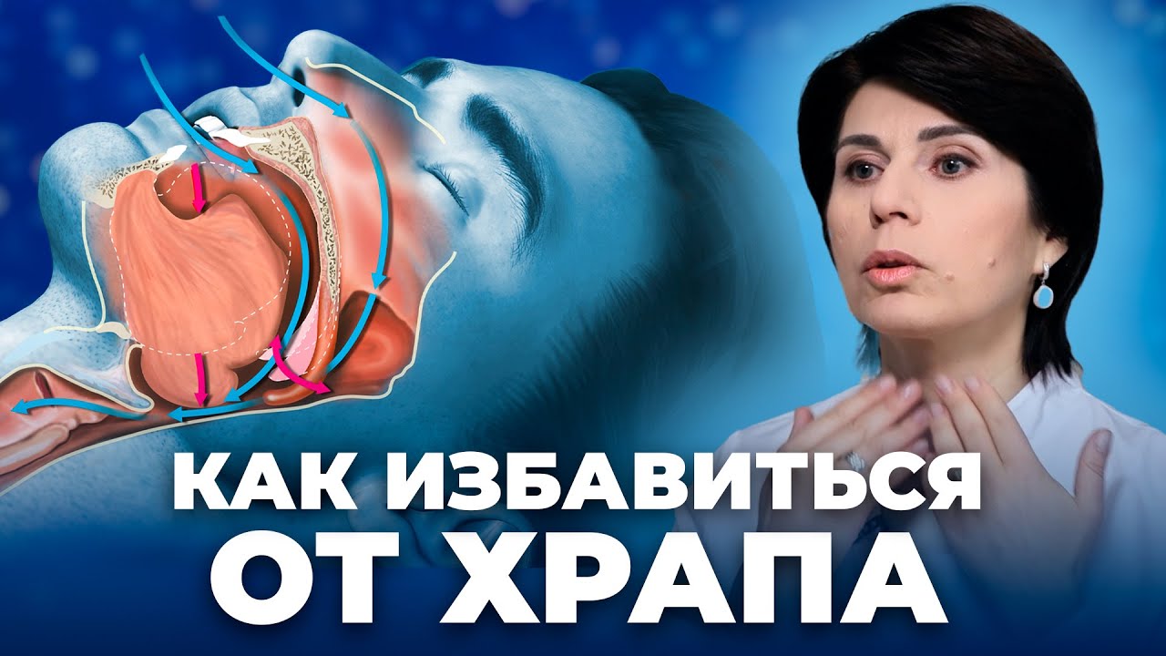 Как избавиться от храпа без лекарств и операций? Простые способы от врача