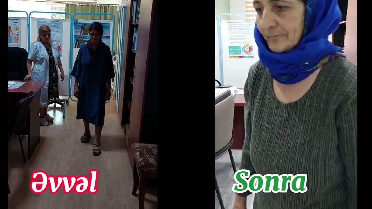 10 ildir əl və ayaqda əsmə, hərəkət məhdudluğu olan #Parkinson xəstəsinin N&ouml;vbəti Uğurlu Nəticəsi ✅