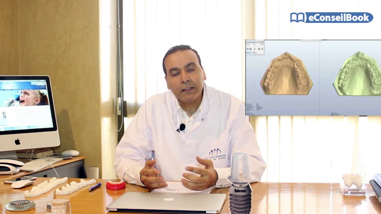 تقويم الأسنان بالقوالب الشفافة