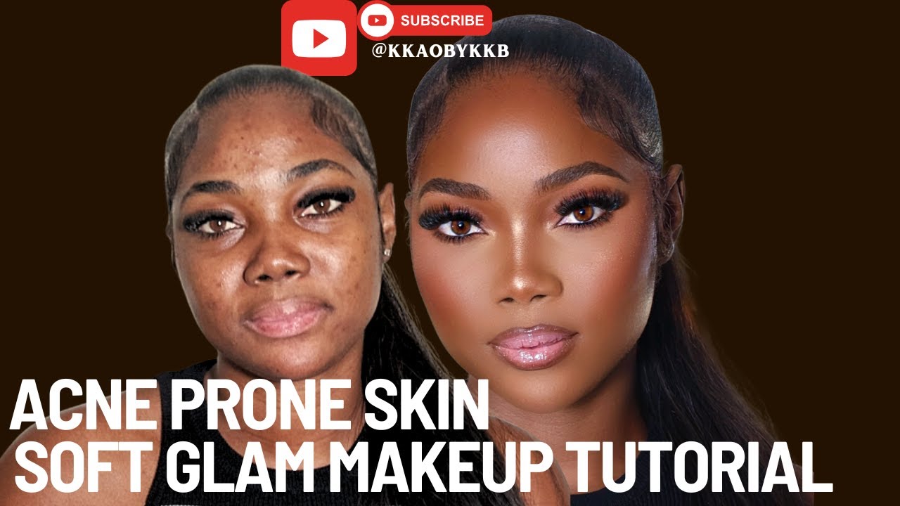 Soft Glam Makeup Tutorial Acne