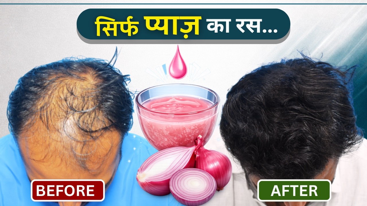 Does Onion Juice Control Hair Fall | क्या प्याज बालों के झड़ने में काम करता है|Secret to Healthy Hair