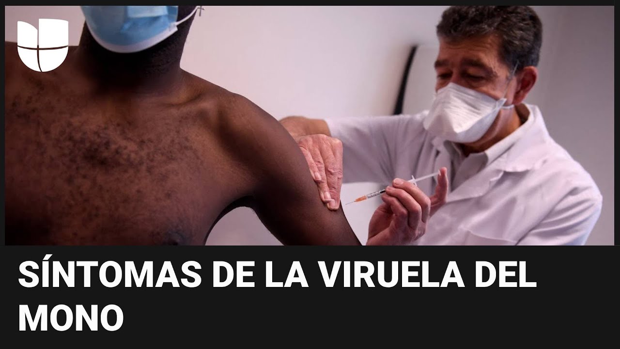 La viruela del mono: estos son los síntomas más comunes y la mejor manera de protegerse del virus