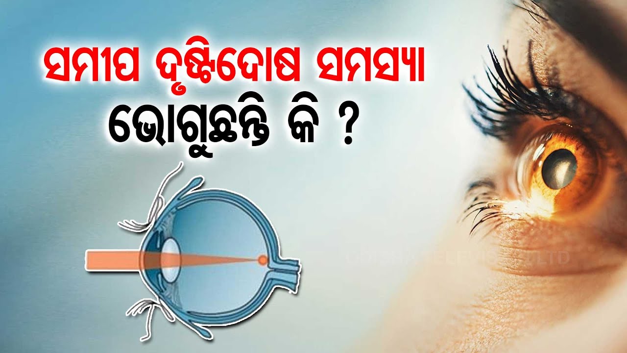 Doctor Doctor | What Is LASIK Eye Surgery