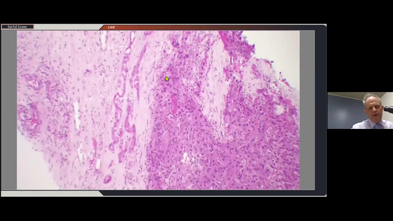 Hepatology Clinico-Pathological case presentations - Prof Martin Hale
