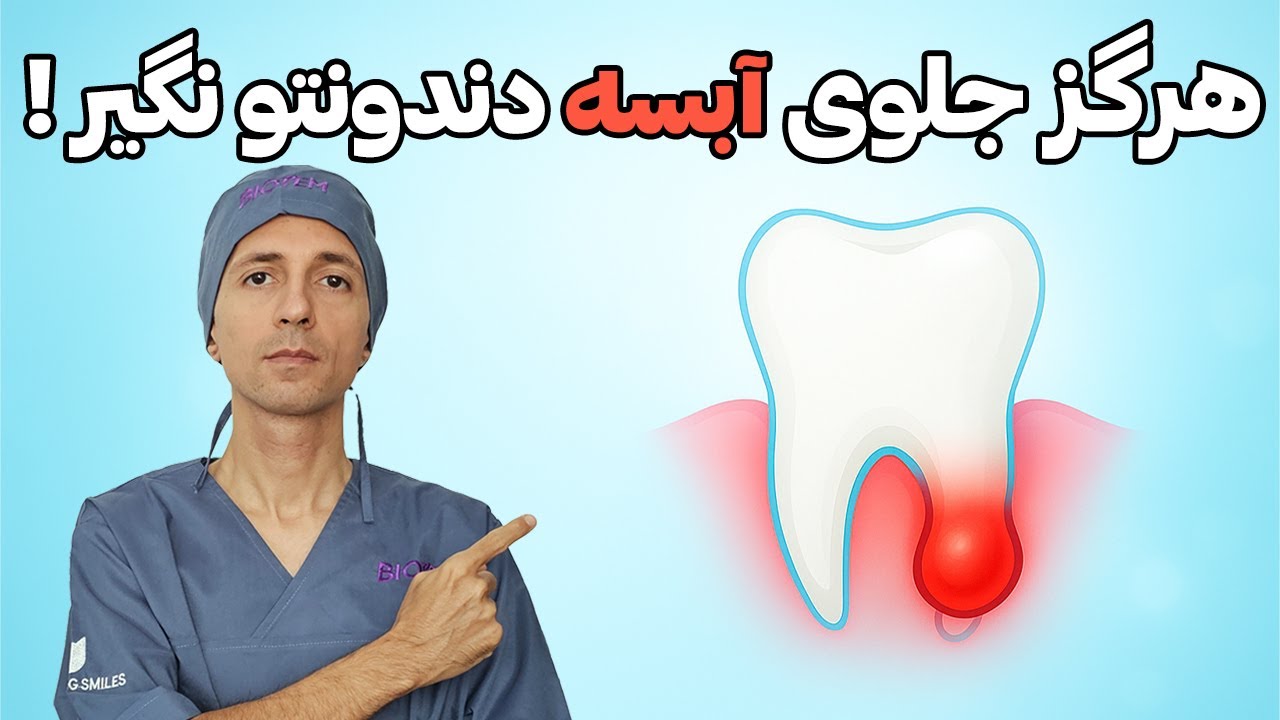 😱 هرگز جلوی آبسه‌ی دندونت رو نگیر! دلیلش شوکه‌ات می‌کنه