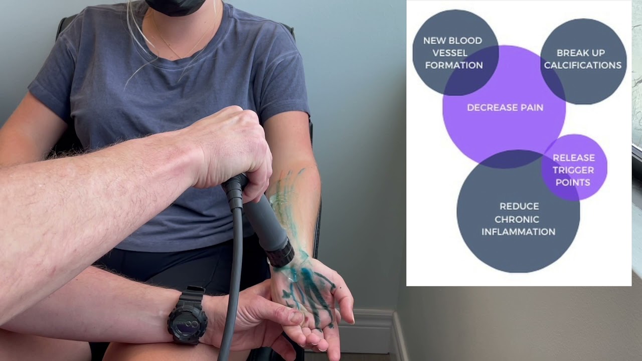 Carpal Tunnel Relief with Shockwave & Soft Tissue Therapy: Dr. Steve Knighton’s Expert Treatment