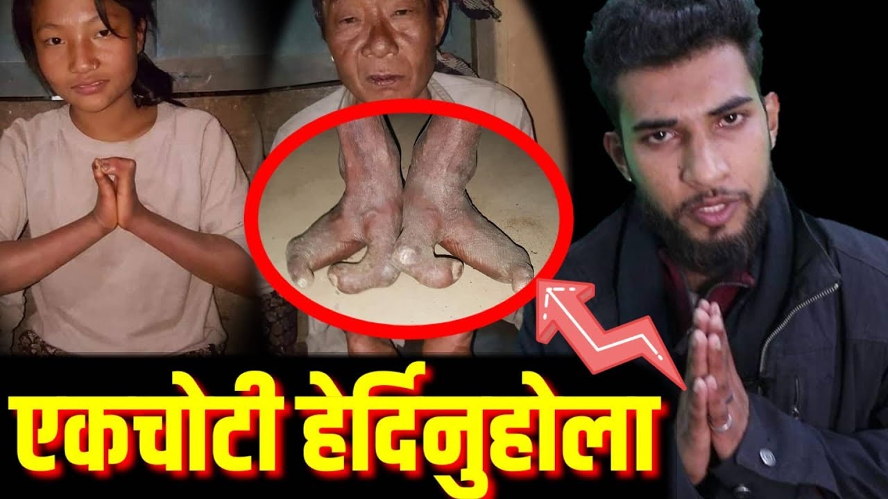 भाग्य न्यौपाने रुदै... यो भिडियो सबैले हेर्नुहोला भोजपुरमा यस्तो भयो.. Bhagya Neupane, Kumar Rai