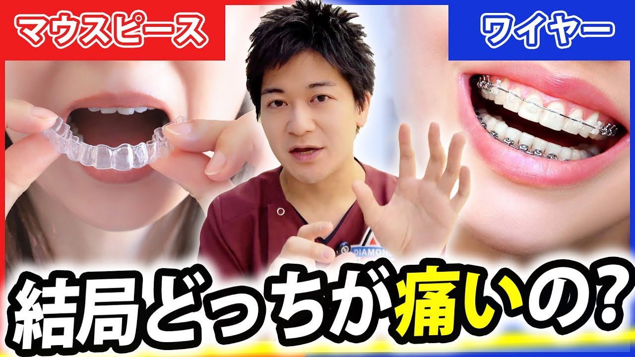 【マウスピース矯正VSワイヤー矯正】どっちが痛い？