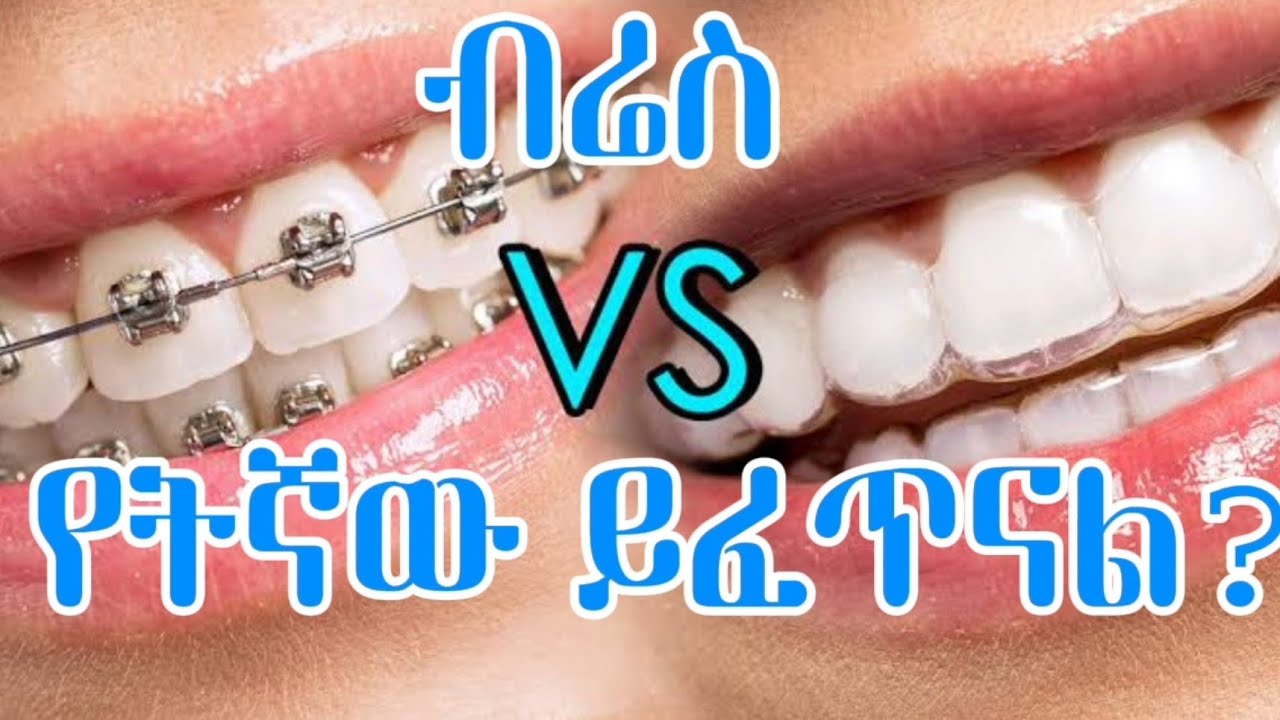 የትኛው የብሬስህክምና ፈጣን ነው?የትኛው ርካሽ ነው?