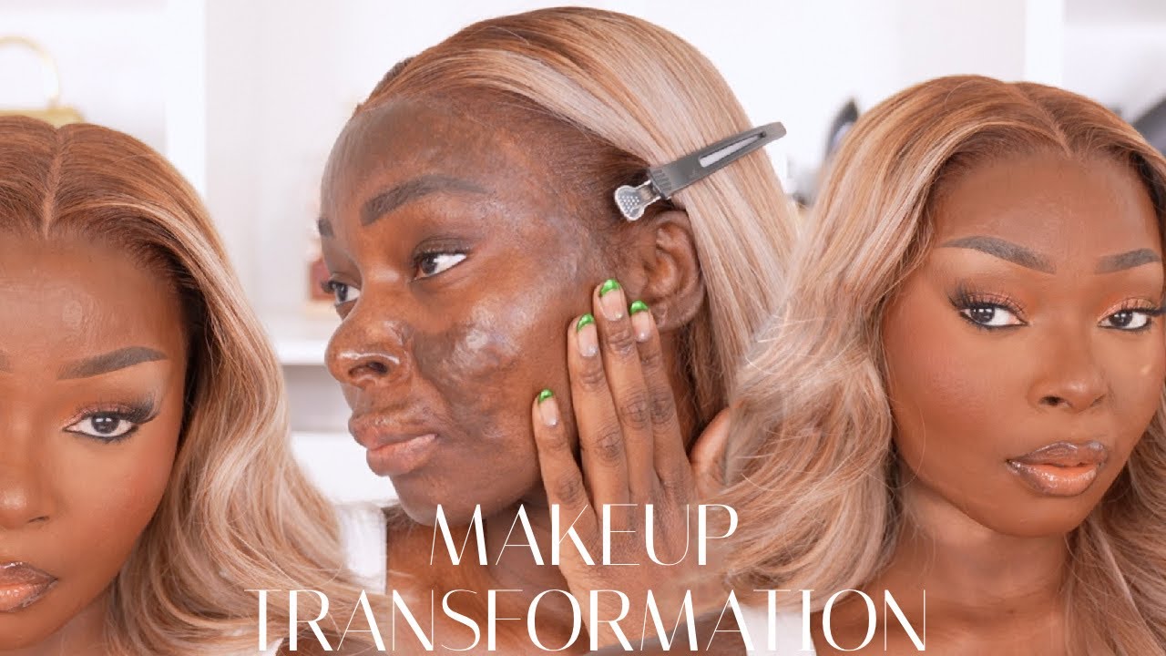 My New Makeup Transformation Since My SCARS Got BETTER! | Shalom Blac