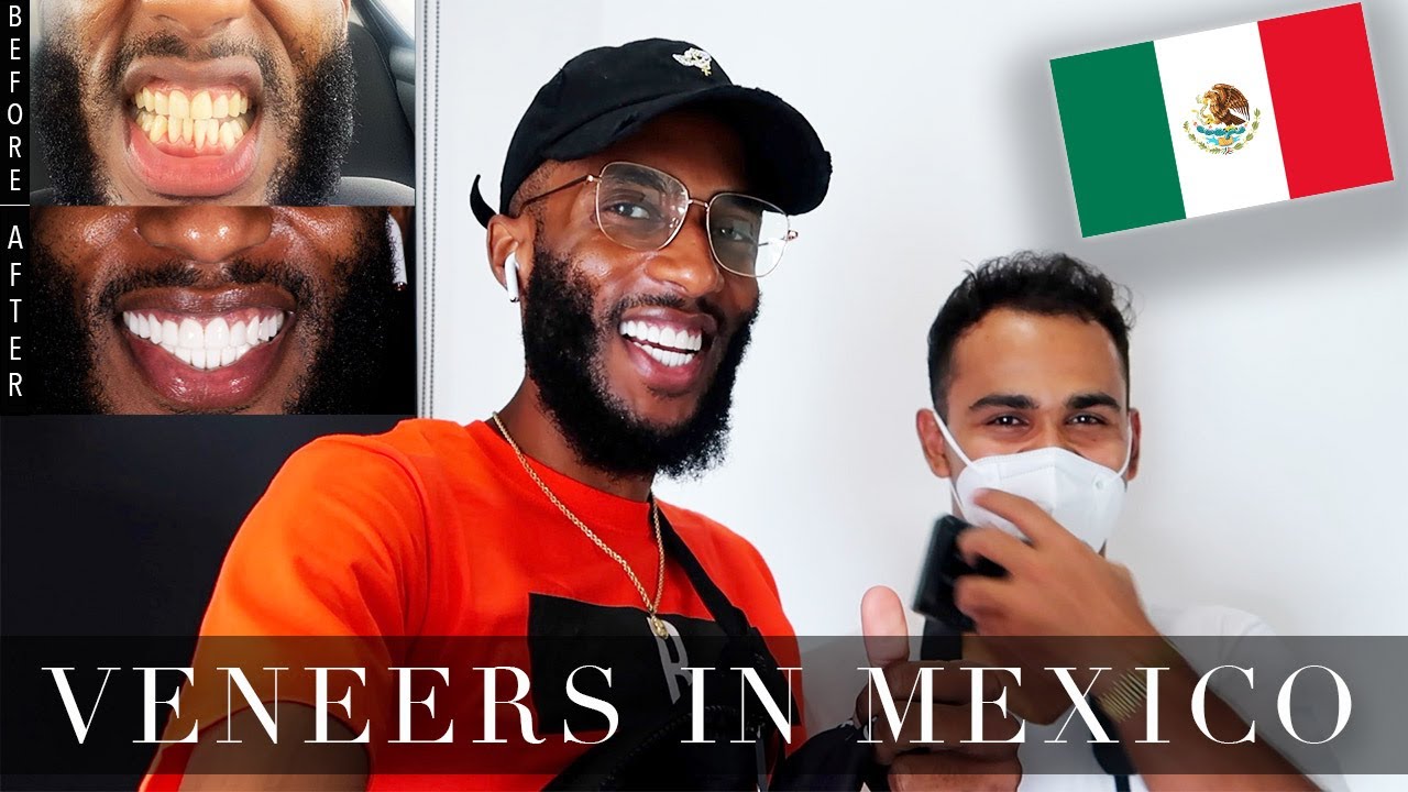 Улыбка на миллион долларов в Мексике 😁🇲🇽 | Фарфоровые коронки/виниры | Видеоблог №39