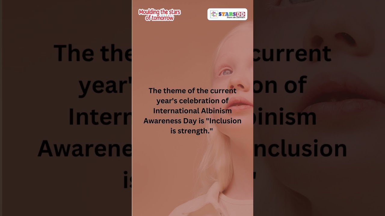 International Albinism Awareness Day - June 13