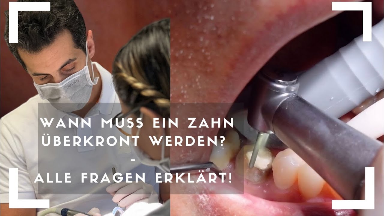 Warum muss ein Zahn überkront werden? - Pro und Kontra + Ablauf