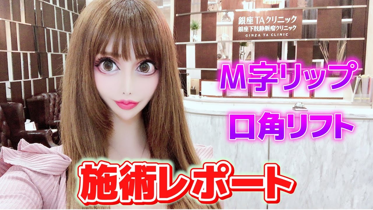 【唇整形】M字リップ形成と口角リフトの施術を受けてきました！