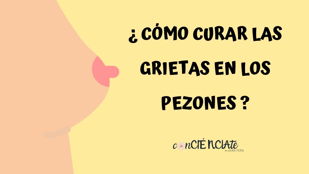 ¿CÓMO CURAR LAS GRIETAS EN LOS PEZONES?