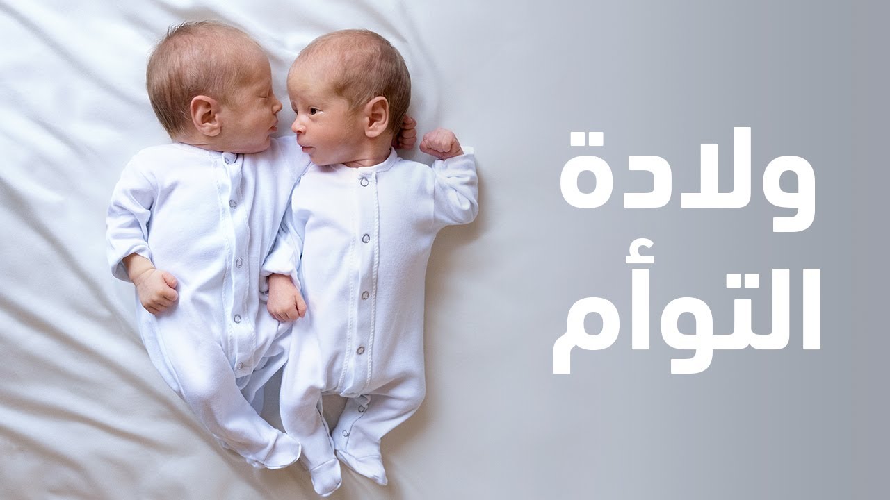 ولادة التوأم