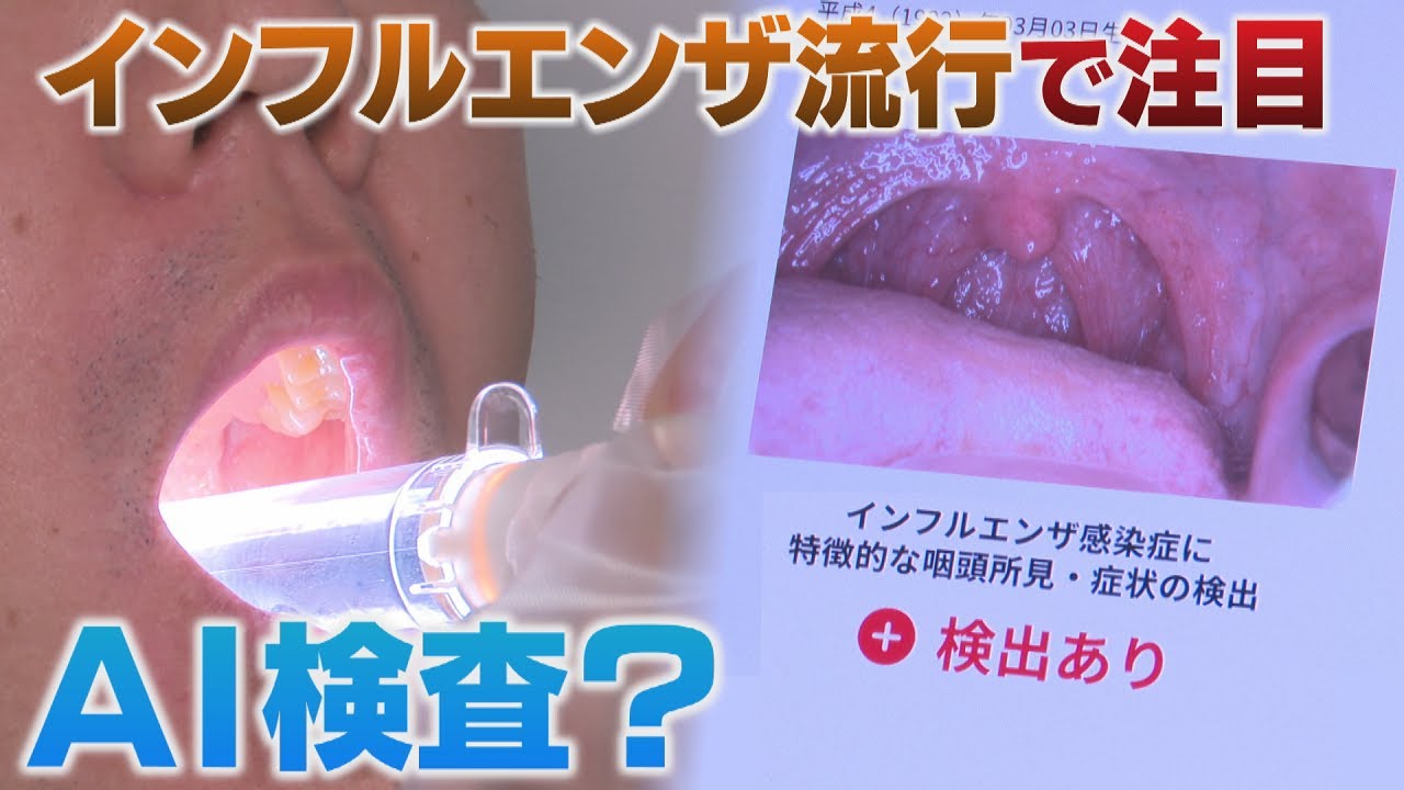 福岡県に「インフルエンザ注意報」　昨年より３週間早い発表　ＡＩを活用した新しい感染検査システム