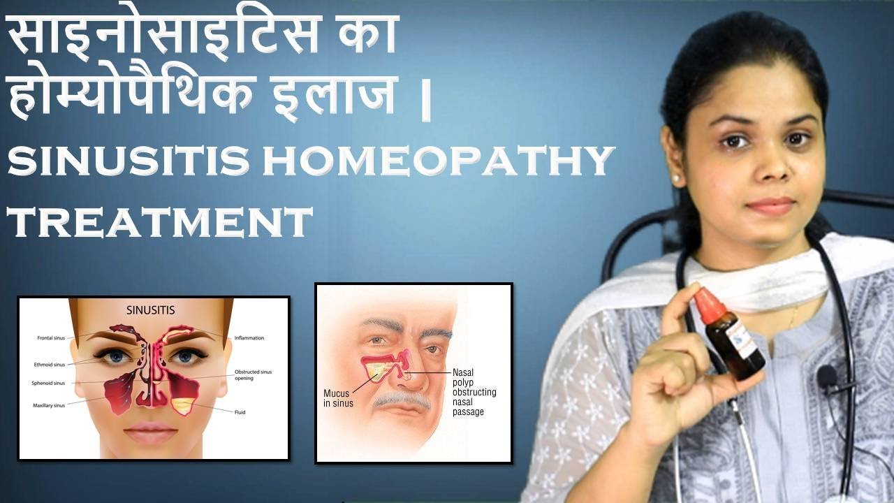 Sinus homeopathic medicine | sinusitis symptoms, causes & homeopathic treatment| हिंदी