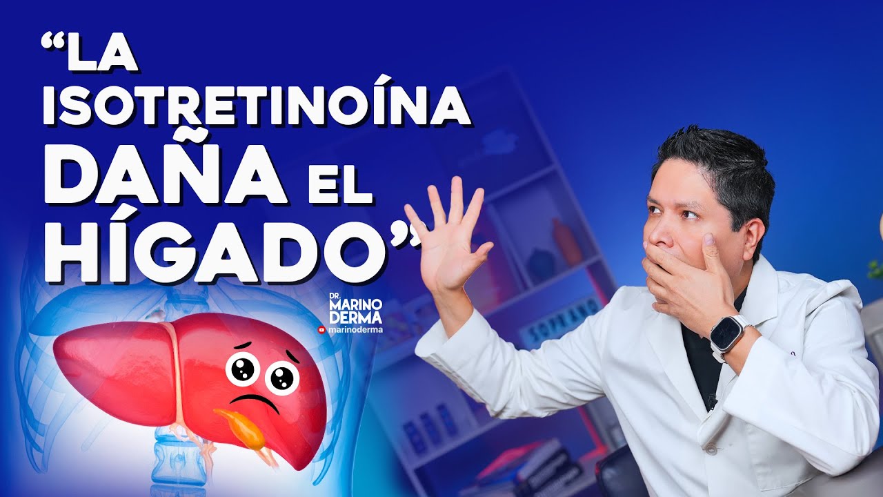 LA ISOTRETINOÍNA DAÑA EL HÍGADO