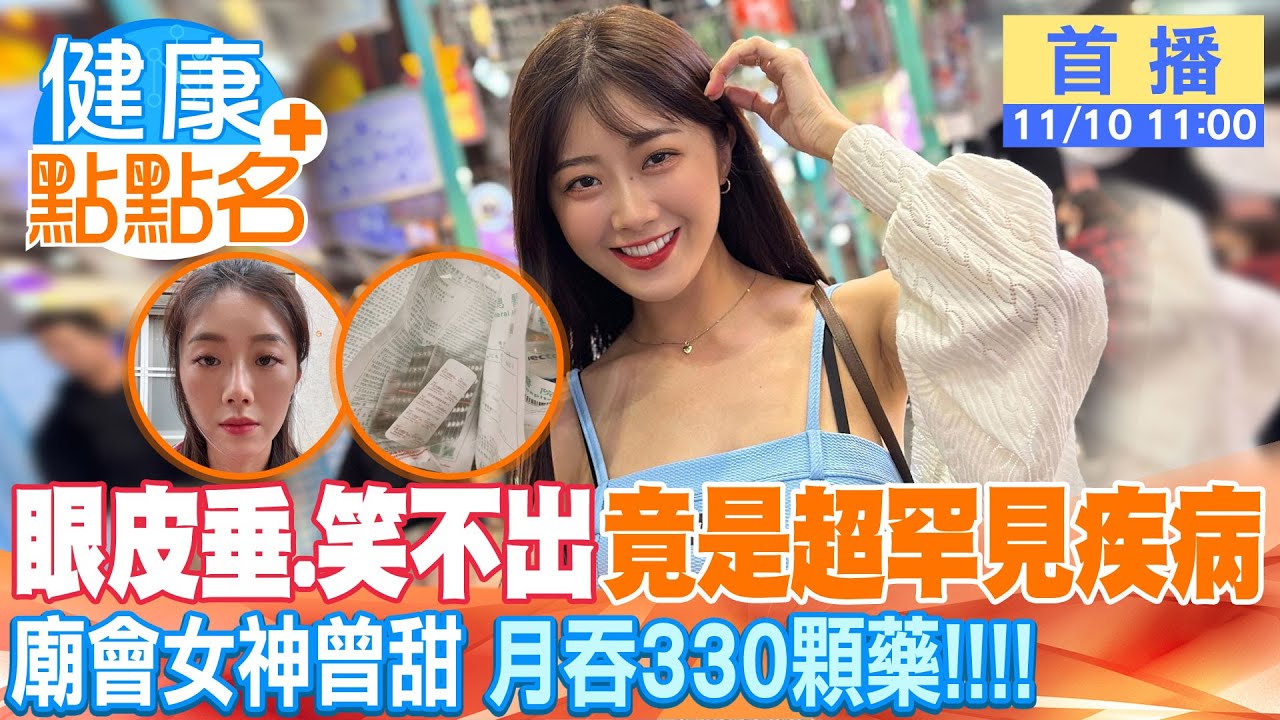 廟會女神曾甜「眼皮下垂、笑不出來」竟是超罕見疾病「重症肌無力」！月吞