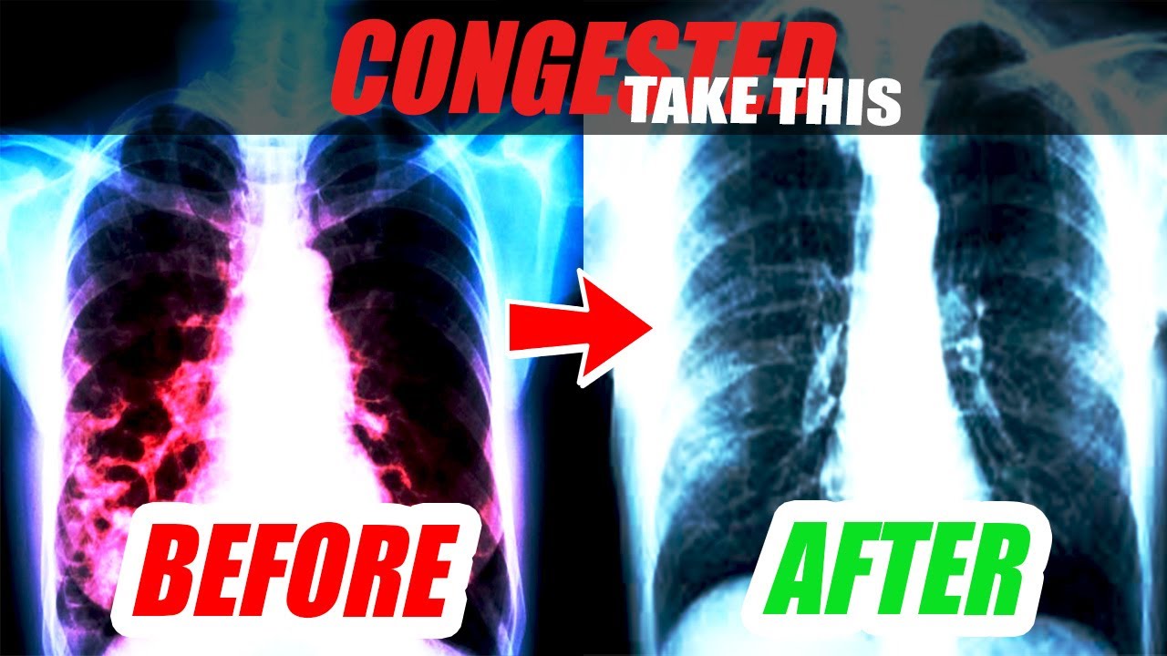 💊VITAMINS to DECONGEST your LUNGS | Healthy Lifestyle