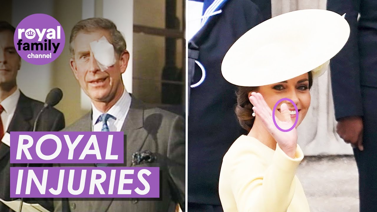 Regal Bumps and Bruises: A Look at the Royals' Public Injuries