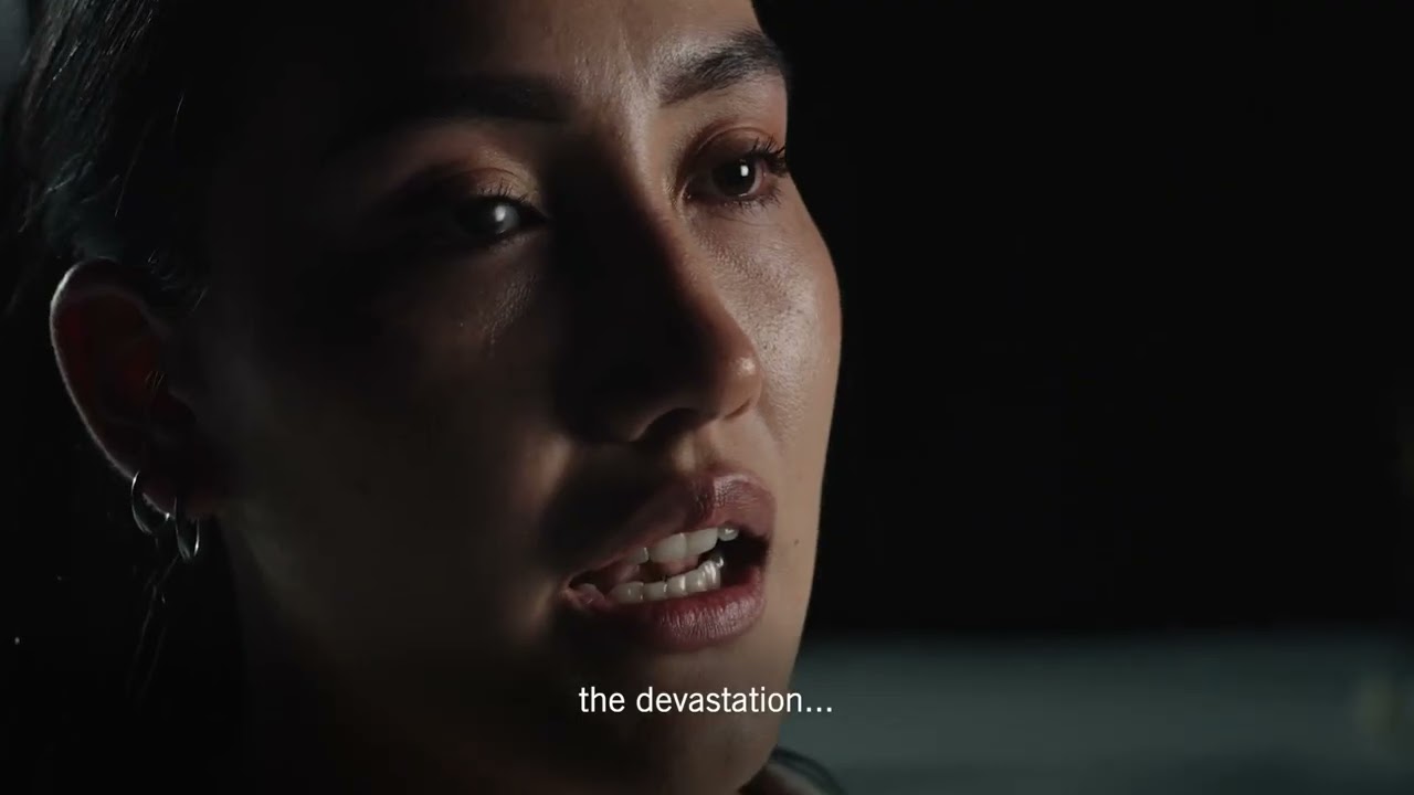 I lost my eye to a rubber bullet fired by police at a protest