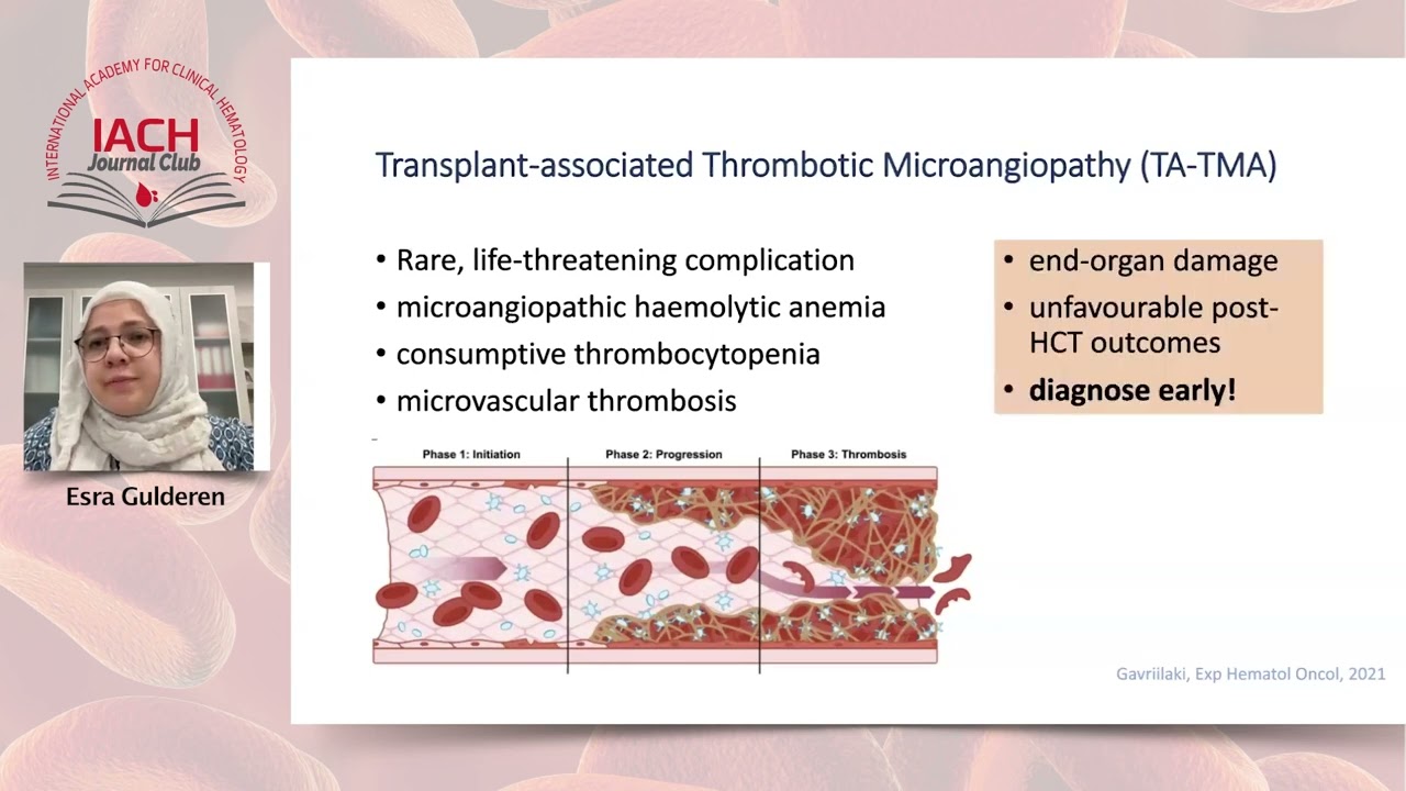 A Challenging Odyssey through AML: Confronting aGvHD, TMA, PRES after alloHCT