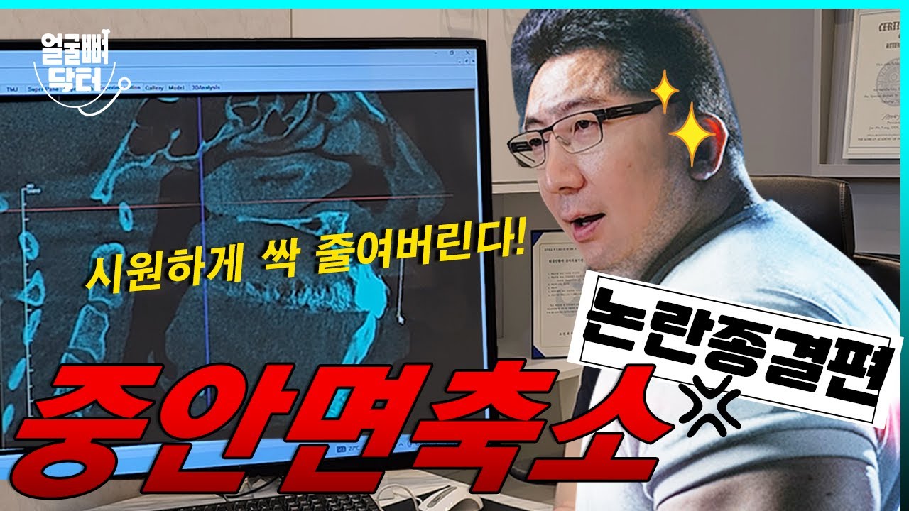 중안면 길이 축소, 양악수술로 할 수 있다? 없다?