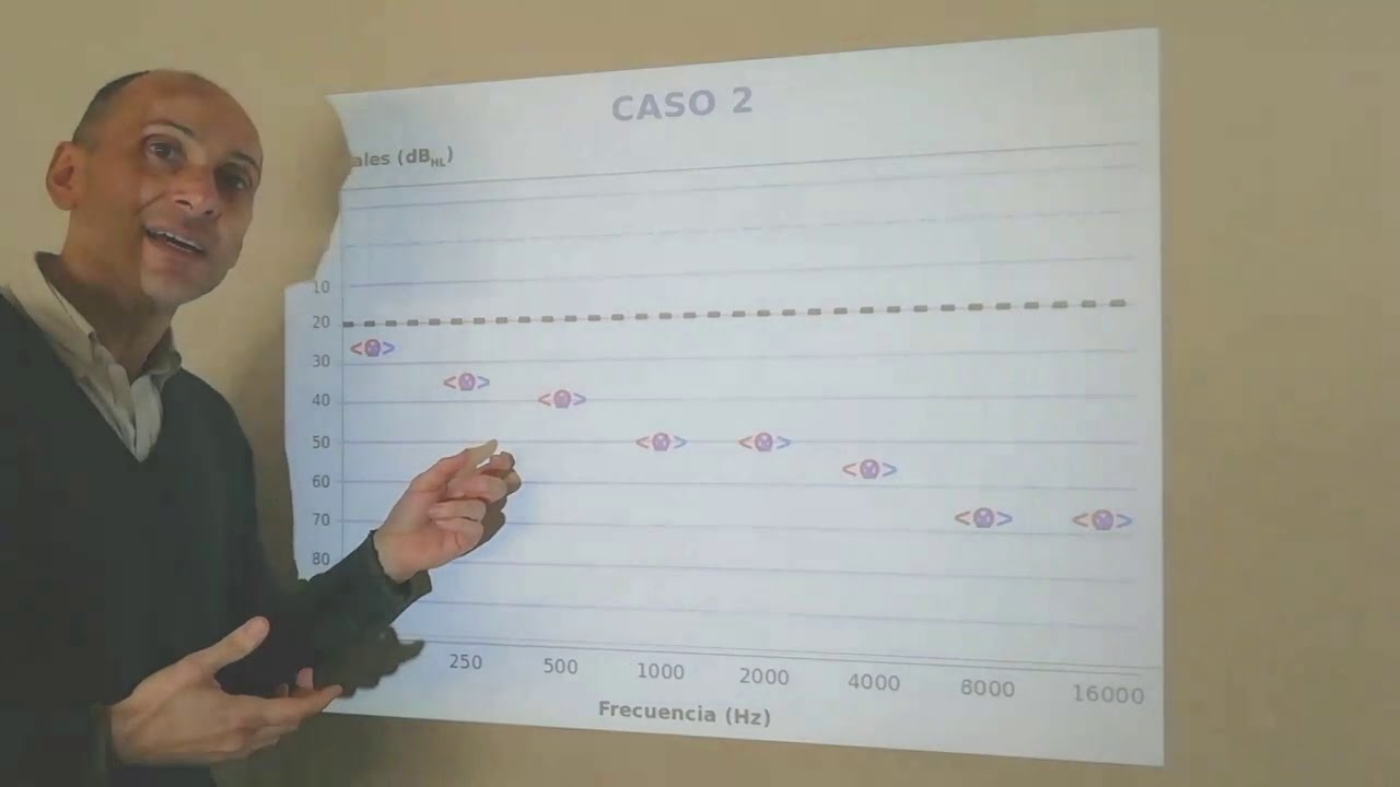 Hipoacusias. Cómo leer un audiograma