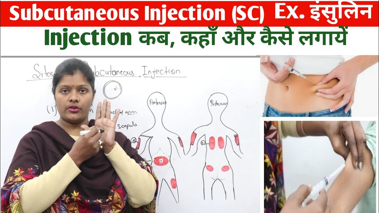 Route, angle & sites of subcutaneous injection (SC) || सबक्यूटेनिअस  इंजेक्शन कहाँ, कब और कैसे दें |