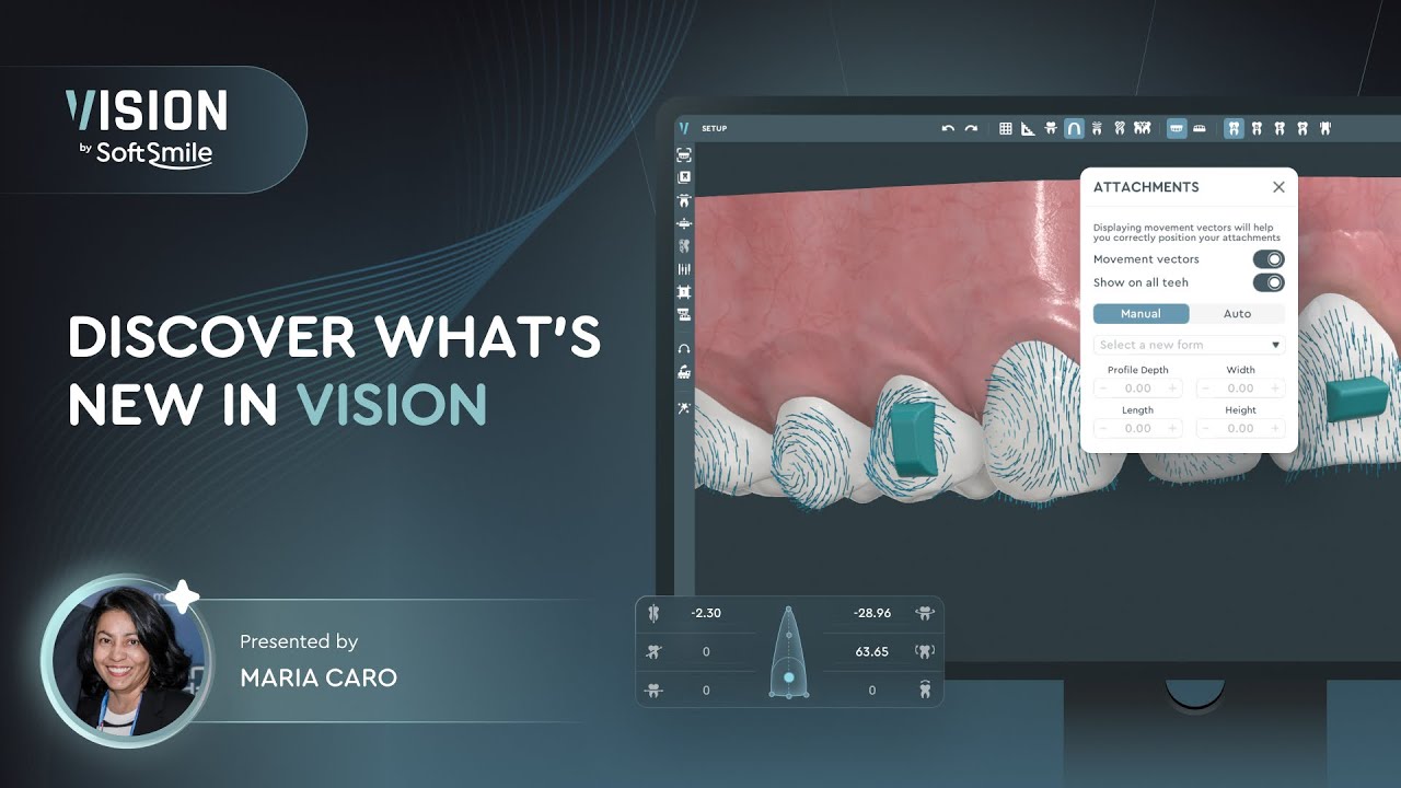 Webinar: Discover What’s New in Vision