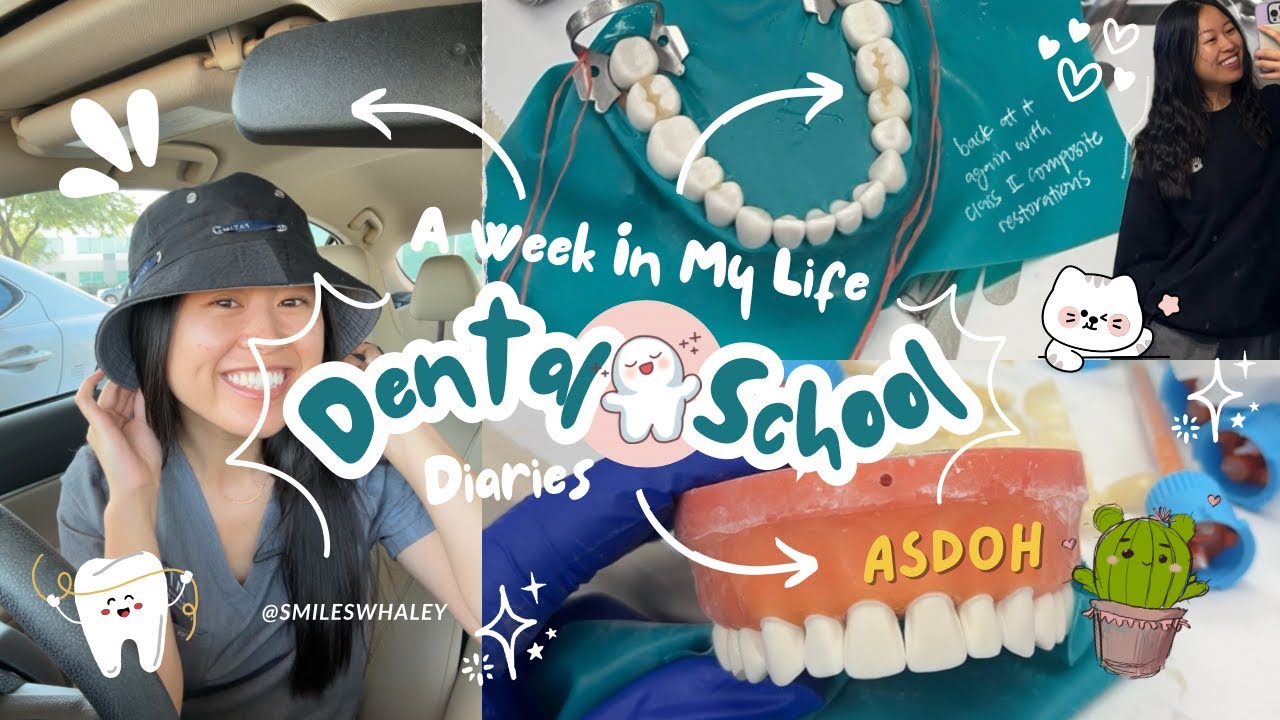 LIFE IN DENTAL SCHOOL | dental school diaries, D2 year vlogs, fixed prosth