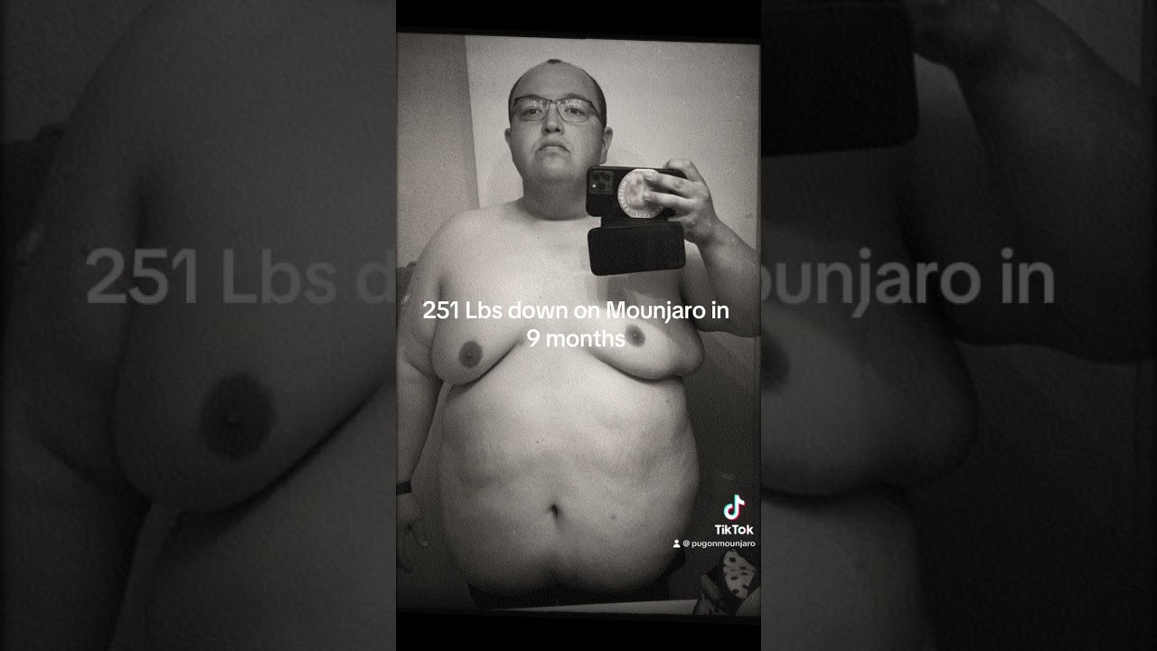 9 months Mounjaro transformation 251 lbs down #mounjaro #weightloss #weightlosstransformation